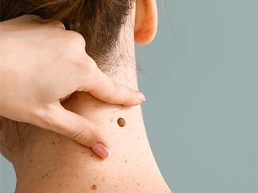 Mole-Tag